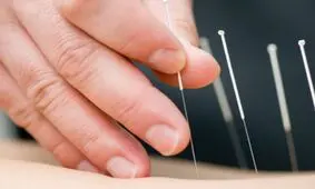 لاغری شکم و پهلو با طب سوزنی