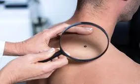 کشف جدیدی که سرطان را به خواب می‌برد