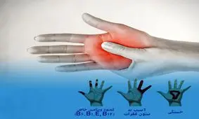 علت سوزن سوزن شدن دستها چیست؟