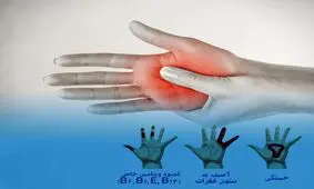 علت سوزن سوزن شدن دستها چیست؟