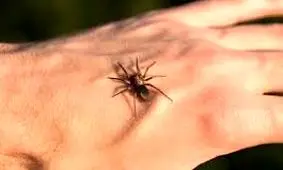 لحظه خارج کردن عنکبوت زنده از گوش زن باردار/ ویدئو