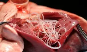 دانستنی‌های درباره کرم‌های روده