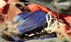 ربات قلب برای حرکت ماهیچه های قلب