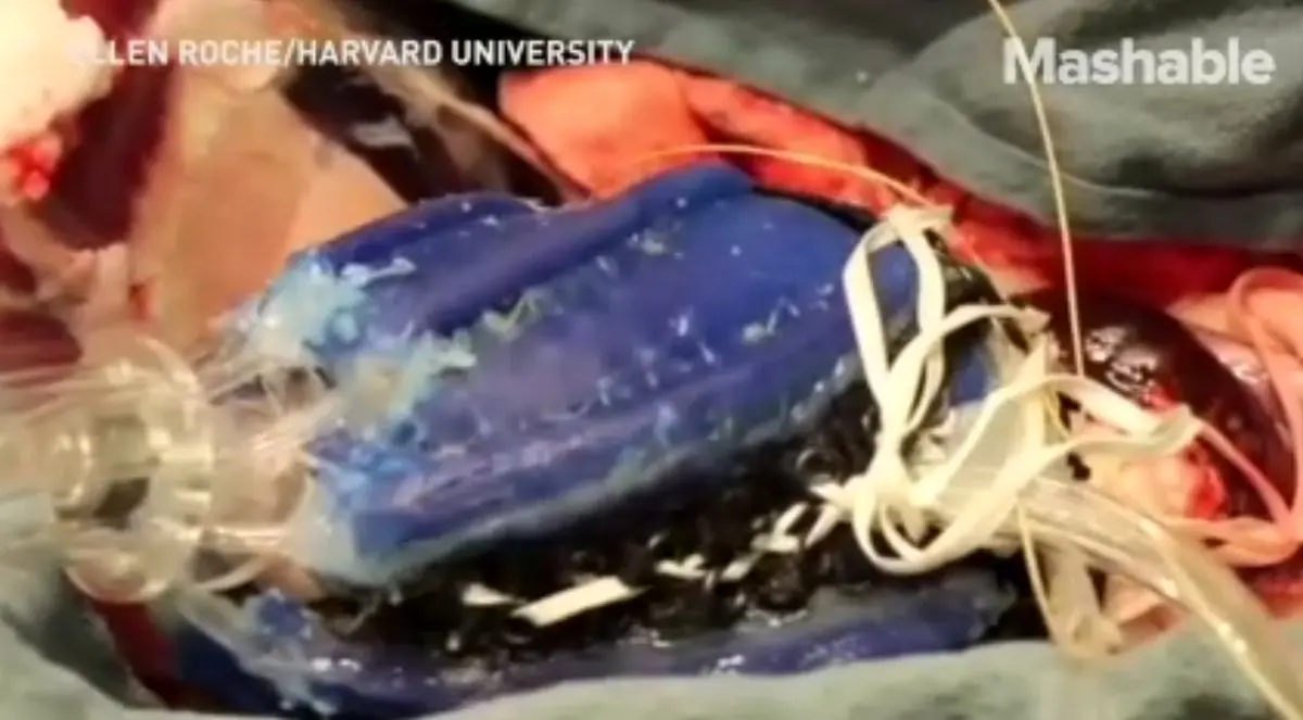 ربات قلب برای حرکت ماهیچه های قلب