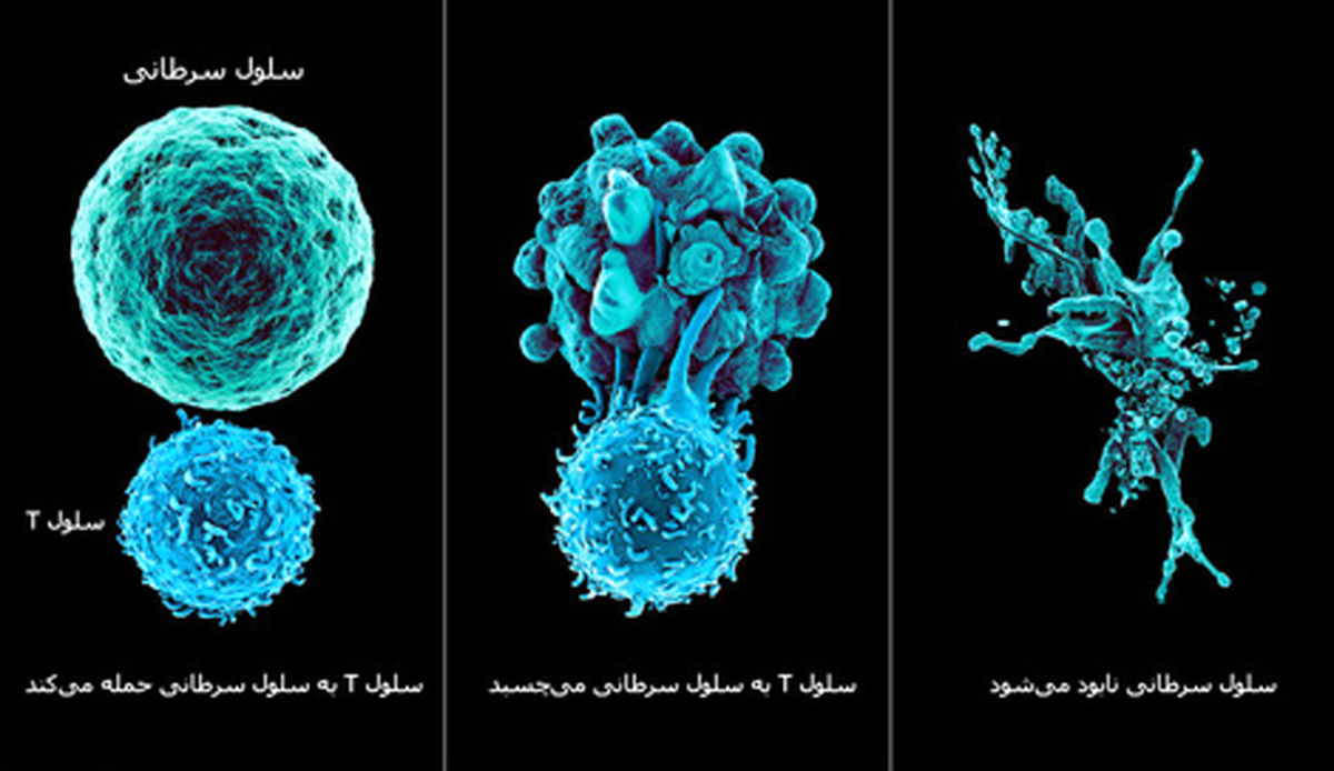 ایمنی درمانی سرطان چیست؟