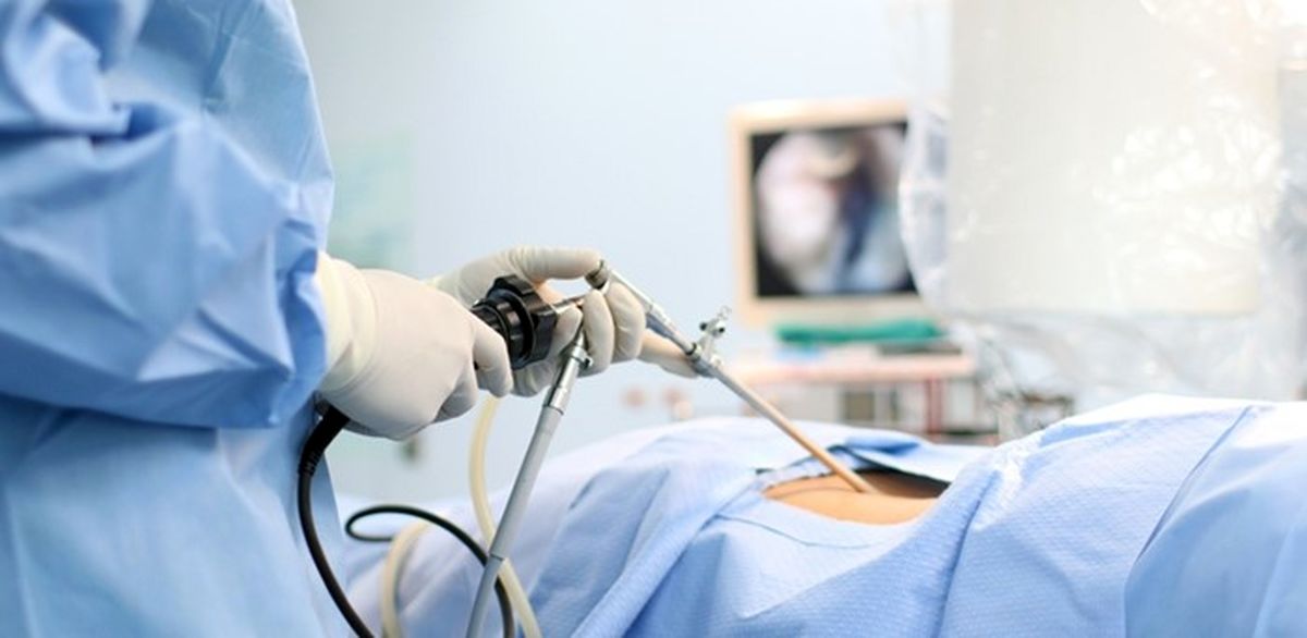 لاپاراسکوپی رحم چیست و چگونه انجام میشود؟