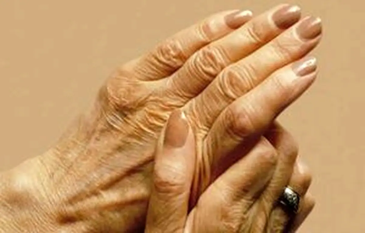 آیا می‌توان از تغییرات پوست در پیری جلوگیری نمود؟