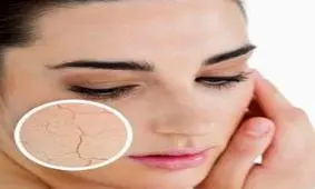 ردپای زمستان را از پوستتان پاک کنید!