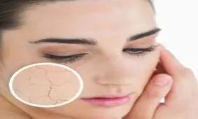 ردپای زمستان را از پوستتان پاک کنید!