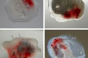 علت مشاهده خون در مایع منی مردان چیست؟