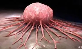 دو ماده خوراکی که افزایش دهنده ابتلا به سرطان روده هستند