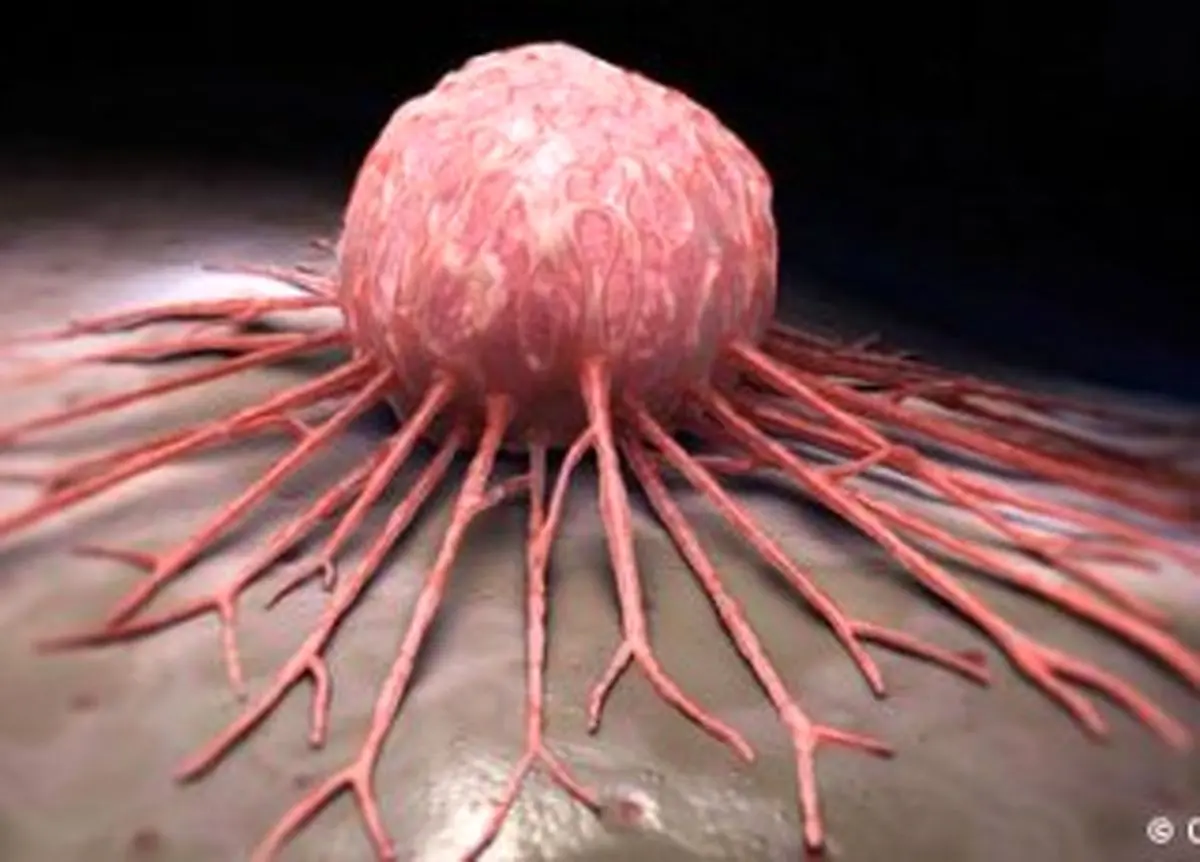 دو ماده خوراکی که افزایش دهنده ابتلا به سرطان روده هستند