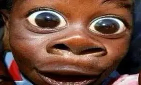 جراجی عجیب و باورنکردنی این پسر (عکس)