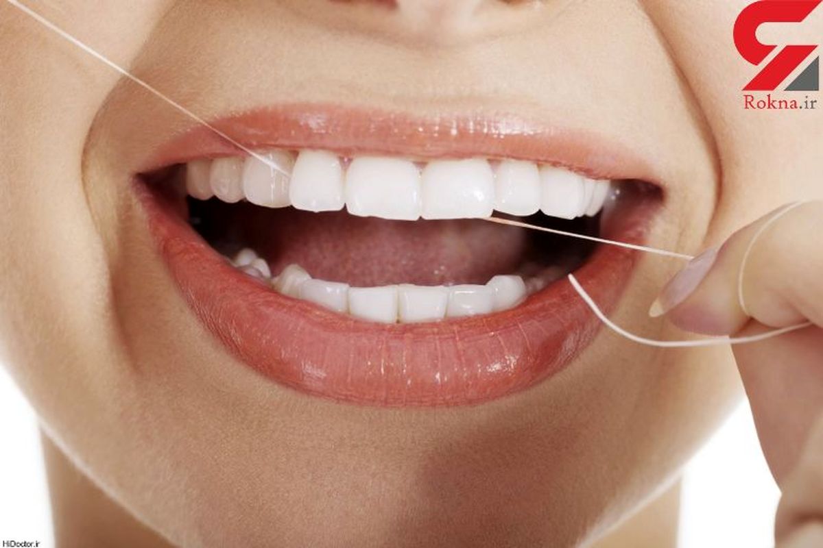تاثیر نخ دندان در زیبایی دندان ها