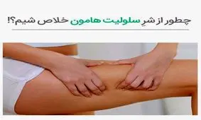 سلولیت چیست و چطور می توانیم درمانش کنیم؟
