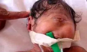 تولد نوزادی عجیب در اسراییل! (+ عکس)