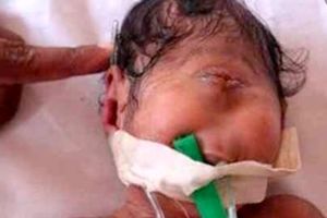 تولد نوزادی عجیب در اسراییل! (+ عکس)