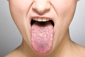طب سنتی در مورد خشکی دهان چه می‌گوید؟
