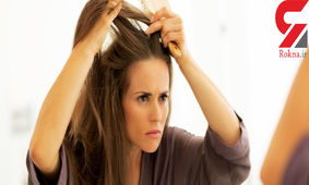 علت ریزش مو در جوانی
