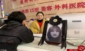 وسوسه زیبایی بلای جان دختر جوان شد! +تصاویر