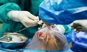 اهدای عضو جوان مرگ مغزی به ۶ بیمار جان دوباره بخشید