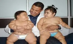 چاق ترین دوقلوهای سنگین وزن ۱۰ ماهه