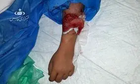 جزییات حادثه وحشتناک حمله دو سگ به دختر ۱۰ ساله در لواسان