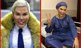 مرد عروسکی برای عمل زیبایی به ایران آمد