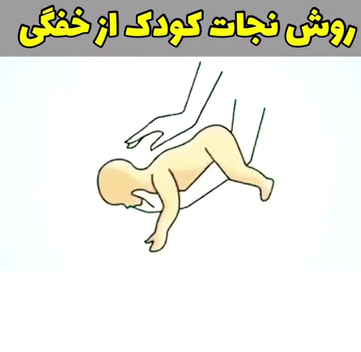 روش نجات کودک از خفگی