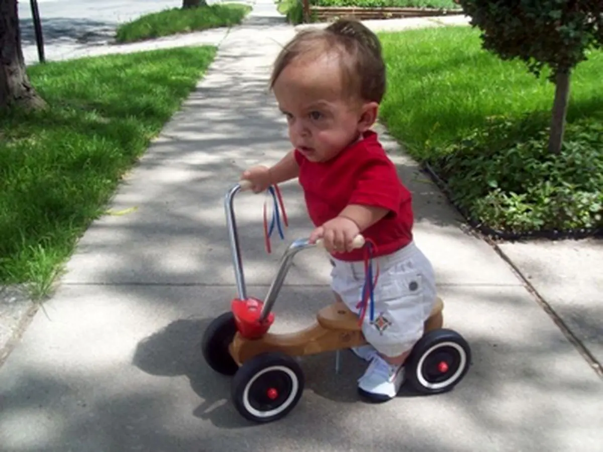 علل و درمان بیماری آکندروپلازی