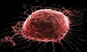 پیش‌بینی سرطان پستان با کمک یک سیستم آنلاین