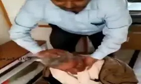 بی حسی عجیب دندان پزشک تجربی