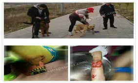 واکنش ها نسبت به حمله سگ به دختربچه ای در لواسان