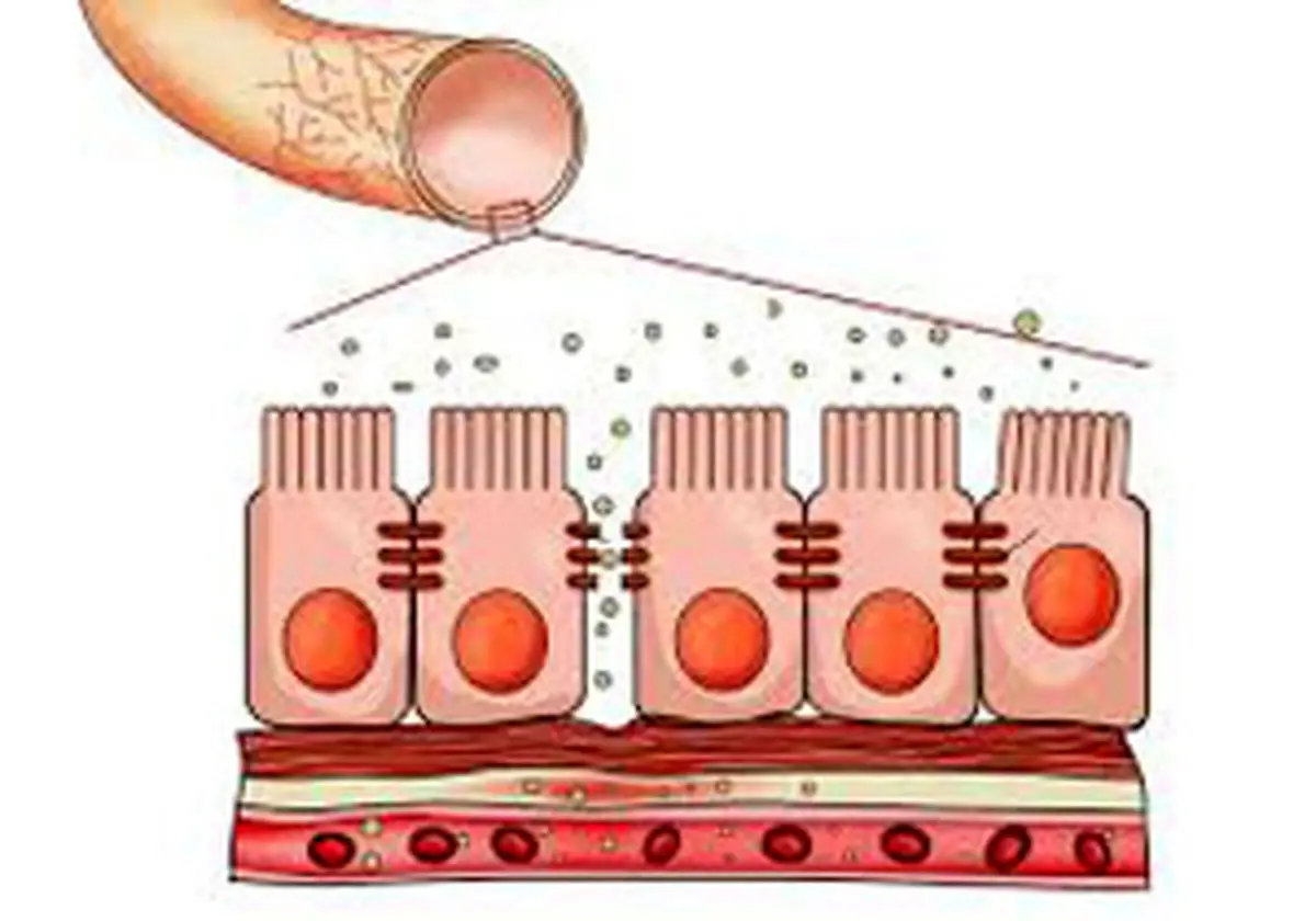 وقتی روده نشت می کند !
