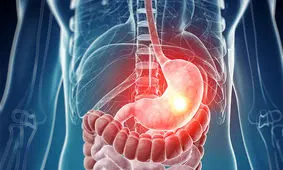 زخم اثنی عشر؛ علائم،‌ دلایل،‌ راه‌های پیشگیری و درمان