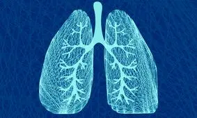 سرطان ریه، عوامل و راه‌های درمان آن