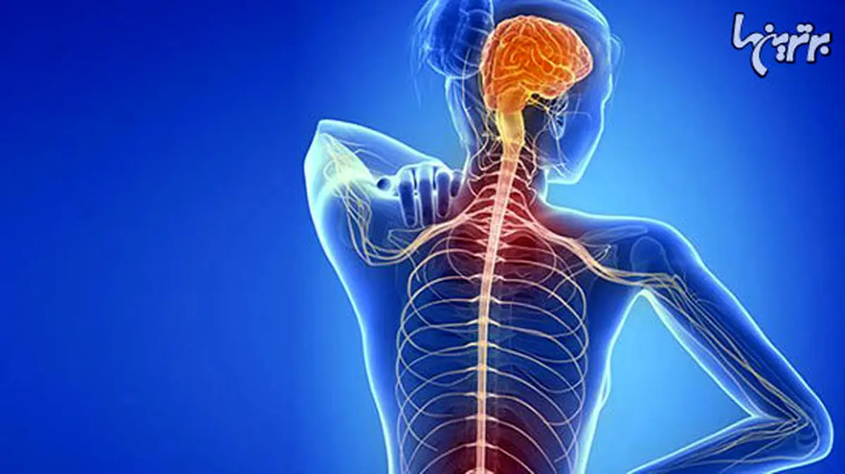 علایم ام اس در زنان چیست؟