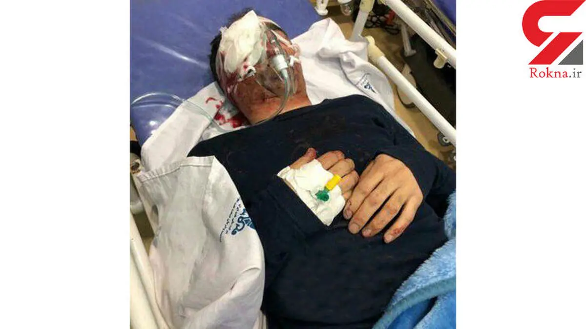 حادثه وحشتناک برای تکنسین هواپیما در اهواز