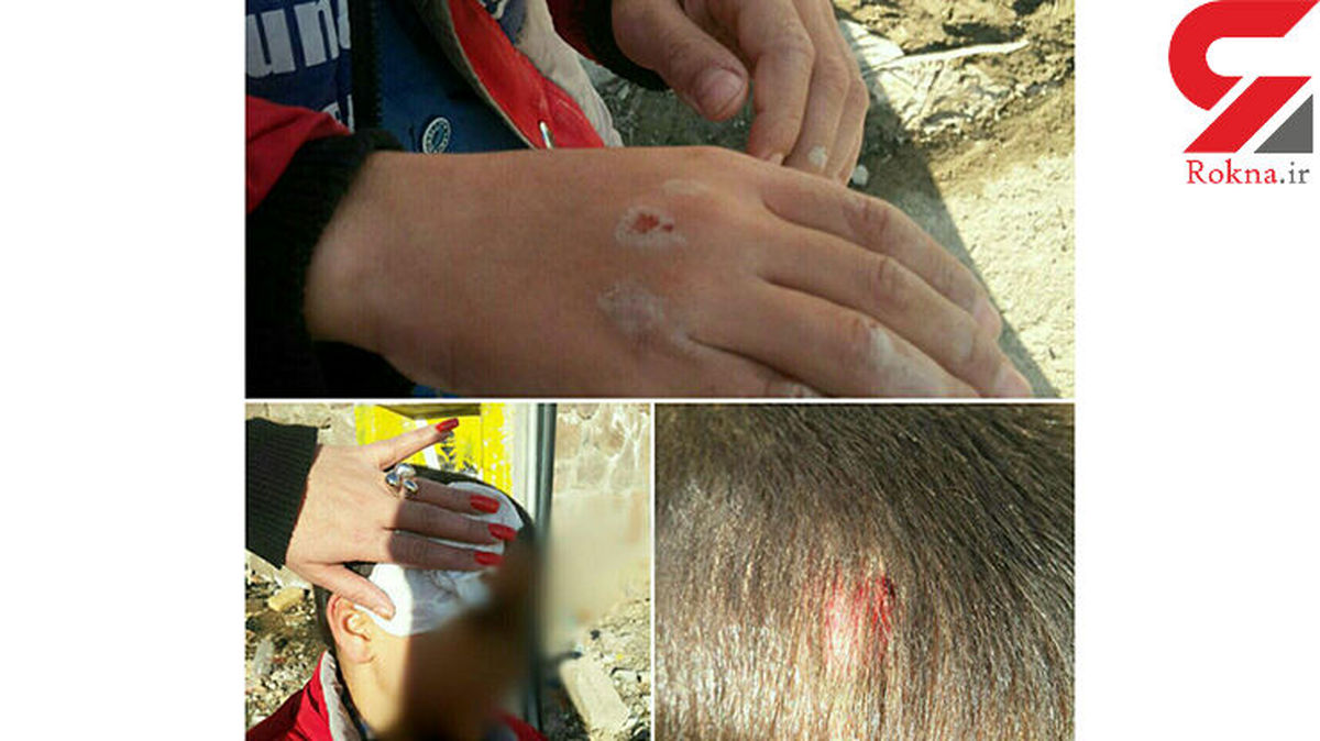 بازهم حمله وحشتناک سگ های ولگرد به یک کودک در حوالی مسکن مهر+عکس