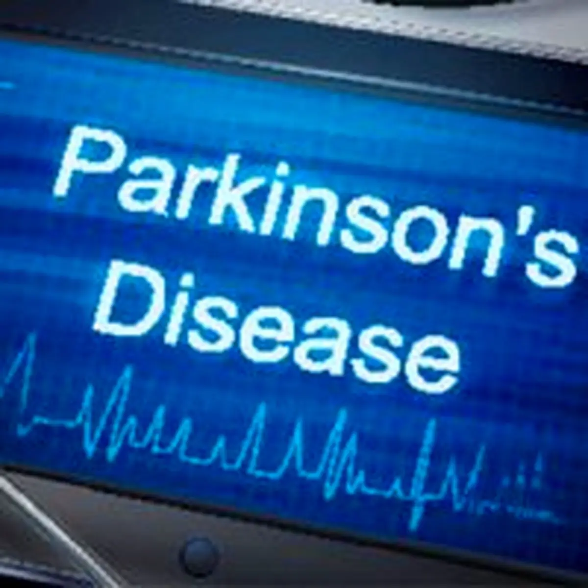 تشخیص پارکینسون با آزمایش خون