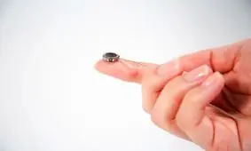 ایمپلنت مغزیِ رقیب نورالینک، وارد فاز آزمایش‌های بالینی شد