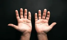 چرا پنج تا انگشت شبیه هم نیستند؟ 