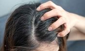 اگزمای پوست سر چیست و چطور درمان می‌شود؟