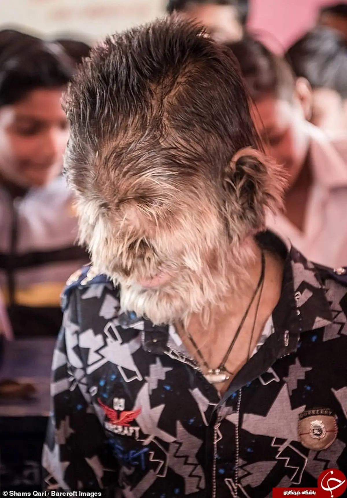 ماجرای حیرت‌آور پسربچه گرگ‌نما در هند +تصاویر