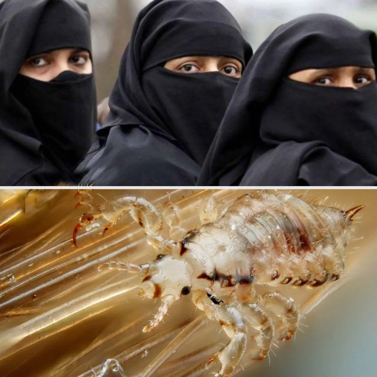شپش های شما را خریداریم