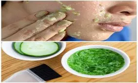 چاقی فوری صورت با معجون شگفت انگیز خیار و گلاب