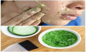 چاقی فوری صورت با معجون شگفت انگیز خیار و گلاب