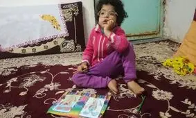 یگانه دختر ایران در پیله بیماری نادر/ رنج نامه فاطمه زهرا