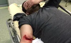 مجروحیت دو تن از بسیجیان تهران در درگیری با سارقین + عکس