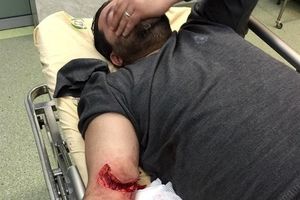 مجروحیت دو تن از بسیجیان تهران در درگیری با سارقین + عکس